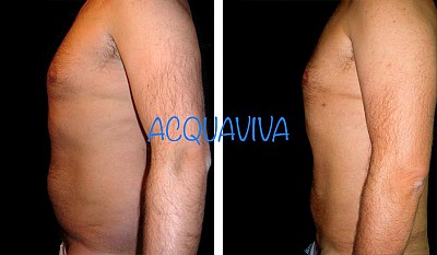 Trattamenti corpo Acquaviva