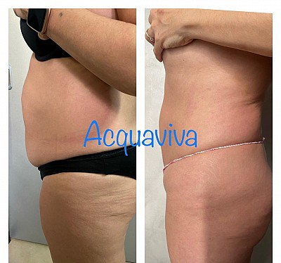 Trattamenti corpo Acquaviva