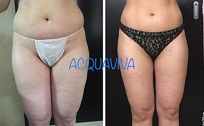 Trattamenti corpo Acquaviva