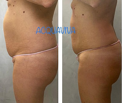 Trattamenti corpo Acquaviva