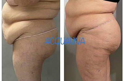 Trattamenti corpo Acquaviva