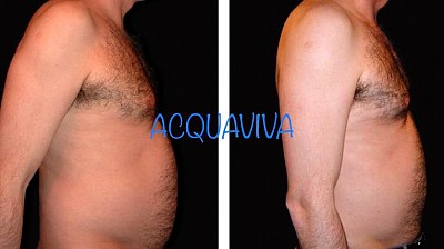 Trattamenti corpo Acquaviva